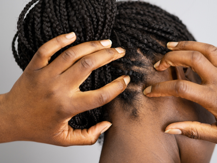 Een pijnlijke hoofdhuid: Alles wat je moet weten over een ontsteking aan de hoofdhuid