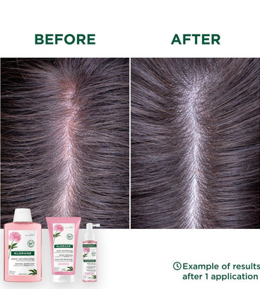 Klorane shampoo Pioenroos - gevoelige hoofdhuid (400 ml)